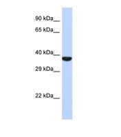 Western blot of Human 721_B. TMPPE antibody dilution 1.0 ug/ml.