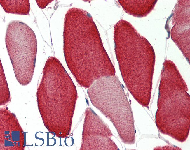 Human Skeletal Muscle: Formalin-Fixed, Paraffin-Embedded (FFPE)