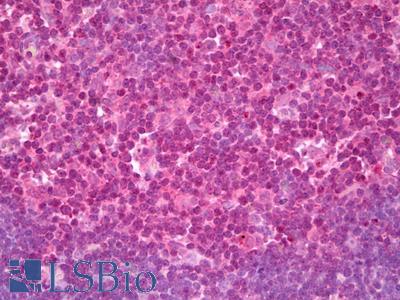 Anti-VAMP3 antibody IHC of human thymus. Immunohistochemistry of formalin-fixed, paraffin-embedded tissue after heat-induced antigen retrieval. Antibody LS-B7522 concentration 10 ug/ml.