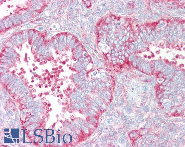 Anti-VAMP3 antibody IHC of human uterus. Immunohistochemistry of formalin-fixed, paraffin-embedded tissue after heat-induced antigen retrieval. Antibody LS-B7211 concentration 10 ug/ml.