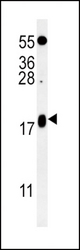 VAMP4 Antibody western blot of K562 cell line lysates (35 ug/lane). The VAMP4 antibody detected the VAMP4 protein (arrow).