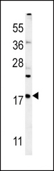 VAMP4 Antibody western blot of mouse liver tissue lysates (35 ug/lane). The VAMP4 antibody detected the VAMP4 protein (arrow).