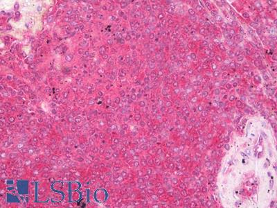 Anti-VAMP7 / SYBL1 antibody IHC of human spleen. Immunohistochemistry of formalin-fixed, paraffin-embedded tissue after heat-induced antigen retrieval. Antibody LS-B7494 concentration 10 ug/ml.
