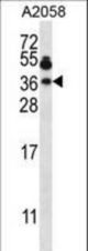 VAMP7 Antibody western blot of A2058 cell line lysates (35 ug/lane). The VAMP7 antibody detected the VAMP7 protein (arrow).