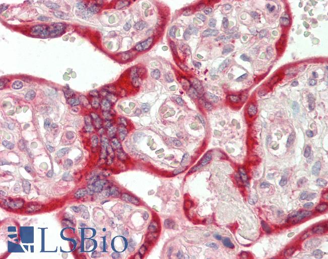 Human Placenta: Formalin-Fixed, Paraffin-Embedded (FFPE)