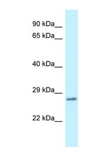 VAMP7 / SYBL1 antibody western blot of Mouse Liver lysate. Antibody concentration 1 ug/ml.