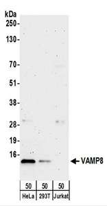 Detection of Human VAMP8 by Western Blot. Samples: Whole cell lysate (50 ug) from HeLa, 293T, and Jurkat cells. Antibodies: Affinity purified rabbit anti-VAMP8 antibody used for WB at 0.4 ug/ml. Detection: Chemiluminescence with an exposure time of 3 minutes.