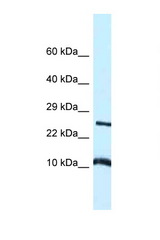 VAMP8 antibody LS-C145343 Western blot of Small Intestine lysate. Antibody concentration 1 ug/ml.