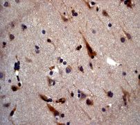 IHC of paraffin-embedded human brain tissue using anti-VAMP8 antibody (LS-C105345).
