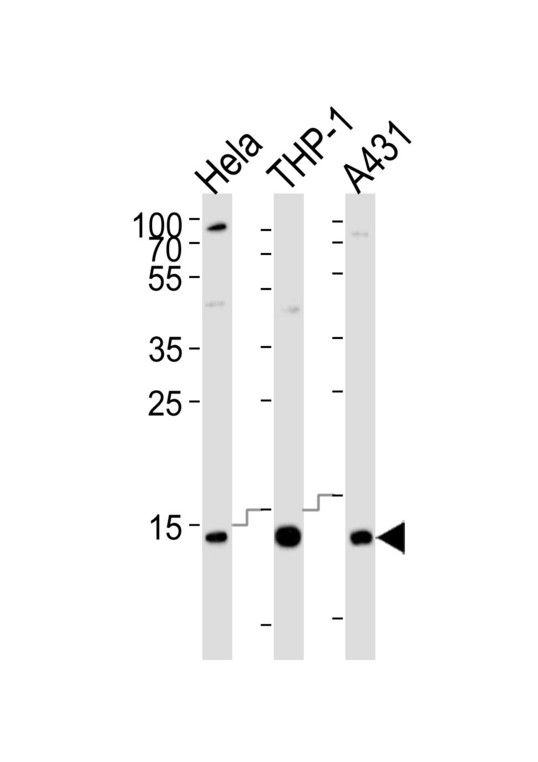 Western blot of lysates from HeLa, THP-1, A431 cell line (from left to right) with VAMP8 Antibody. Antibody was diluted at 1:1000 at each lane. A goat anti-rabbit IgG H&L (HRP) at 1:10000 dilution was used as the secondary antibody. Lysates at 20 ug per lane.