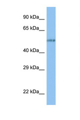 VANGL1 antibody LS-C146137 Western blot of 8226 Cell lysate. Antibody concentration 1 ug/ml.