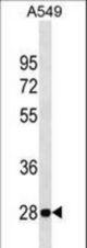 VAPB Antibody western blot of A549 cell line lysates (35 ug/lane). The VAPB antibody detected the VAPB protein (arrow).