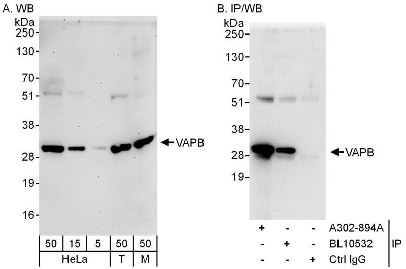 Detection of Human and Mouse VAPB by Western Blot (h&m) and Immunoprecipitation (h). Samples: Whole cell lysate from HeLa (5, 15 and 50 ug for WB; 1 mg for IP, 20% of IP loaded), 293T (T; 50 ug) and mouse NIH3T3 (M; 50 ug) cells. Antibodies: Affinity purified rabbit anti-VAPB antibody used for WB at 0.04 ug/ml (A) and 0.4 ug/ml (B) and used for IP at 3 ug/mg lysate. VAPB was also immunoprecipitated by rabbit anti-VAPB antibody BL10532, which recognizes a downstream epitope. Detection: Chemiluminescence with exposure times of 3 minutes (A) and 10 seconds (B).