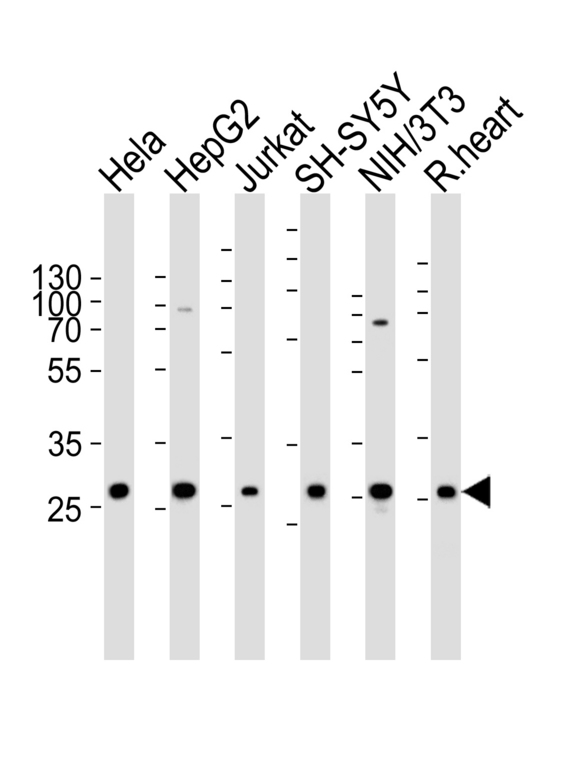 Western blot of lysates from HeLa, HepG2, Jurkat, SH-SY5Y, mouse NIH/3T3 cell line and rat heart tissue lysate (from left to right) with VAPB Antibody. Antibody was diluted at 1:1000 at each lane. A goat anti-rabbit IgG H&L (HRP) at 1:5000 dilution was used as the secondary antibody. Lysates at 35 ug per lane.