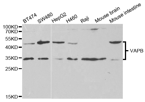 Western blot analysis of extracts of various cell lines, using VAPB antibody.