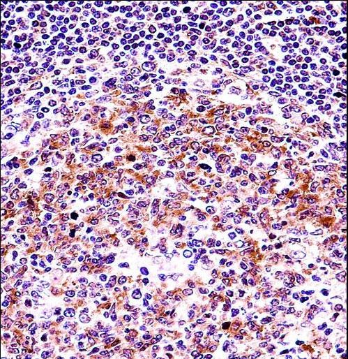 VASP Antibody immunohistochemistry of formalin-fixed and paraffin-embedded human tonsil tissue followed by peroxidase-conjugated secondary antibody and DAB staining.