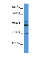 VASP antibody LS-C135941 Western blot of Fetal Heart lysate. Antibody concentration 1 ug/ml.