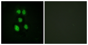 Immunofluorescence of HeLa cells, using VAV1 (Ab-160) Antibody. The picture on the right is treated with the synthesized peptide.