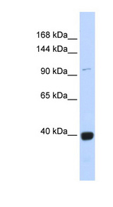 VAV1 antibody LS-C112340 Western blot of Fetal Heart lysate.