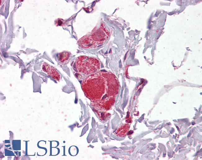Anti-VAV2 antibody IHC of human colon, submucosal plexus. Immunohistochemistry of formalin-fixed, paraffin-embedded tissue after heat-induced antigen retrieval. Antibody LS-B6444 concentration 2.5 ug/ml.
