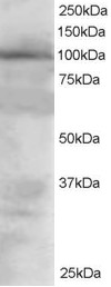 Staining (1.5 ug/ml) of 293 lysate (RIPA buffer, 30 ug total protein per lane). Primary incubated for 1 hour. Detected by chemiluminescence.
