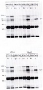 Legend: HEK293 cells were transfected with either empty expression vector (pSR ) or pSRa-Vav2 driving expression of human Vav2. Indicated antibodies (SHD or DPH) were used to immunoprecipitate Vav2 from 300 ug protein lysates. Immunoprecipitated activity was identified by immunoblot of complexes using either DPH (upper gel) or SHD (lower gel) antisera at (1:10000). Immunoprecipitation of Endogenous/Exogenous Vav2 from HEK 283 (75 ug lysate per lane). Top gel - i.p. Ab: DPH or SHD preimmune serum (2.5 ul/300 ug lysate). DPH or SHD alpha Vav2 antiserum (2.5 ul/300 ug lysate). Western Blot Ab: DPH anti Vav2 1:10000. Bottom Gel - i.p. Ab DPH or SHD preimmune sera (2.5 ul/300 ug lysate). DPH or SHD anti Vav2 antisera (2.5ul/300 ug lysate). Western blot Ab - SHD anti Vav2 antibody 1:10000.