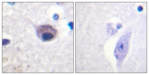 IHC of paraffin-embedded human brain, using VAV2 (Phospho-Tyr142) Antibody. The sample on the right was incubated with synthetic peptide.
