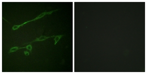 Immunofluorescence of NIH-3T3 cells, using VAV2 (Phospho-Tyr142) Antibody. The sample on the right was incubated with synthetic peptide.