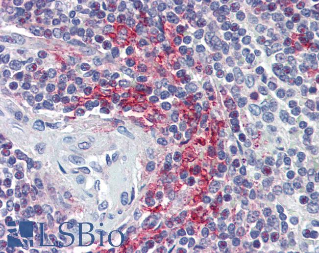Anti-VAV3 antibody IHC of human spleen. Immunohistochemistry of formalin-fixed, paraffin-embedded tissue after heat-induced antigen retrieval. Antibody LS-B3237 concentration 5 ug/ml.