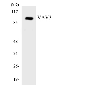Western blot of the lysates from HepG2 cells using VAV3 antibody.