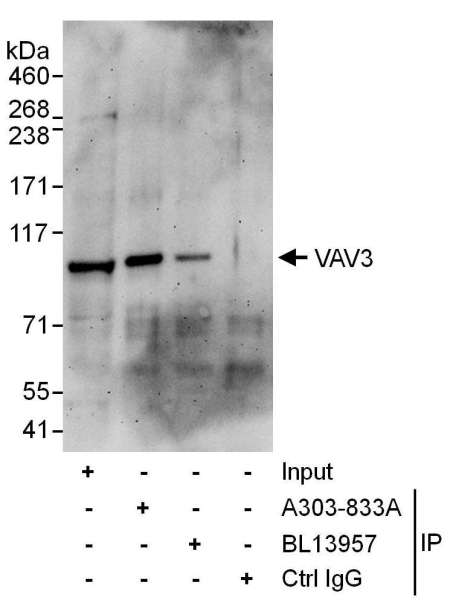 Detection of Human VAV3 by Western Blot and Immunoprecipitation. Samples: Whole cell lysate (50 ug for input; 1 mg for IP, 20% of IP loaded) from Jurkat cells. Antibodies: Affinity purified rabbit anti-VAV3 antibody used for WB at 1 ug/ml and used for IP at 6 ug/mg lysate. VAV3 was also immunoprecipitated by rabbit anti-VAV3 antibody BL13957, which recognizes a downstream epitope. Detection: Chemiluminescence with an exposure time of 3 minutes.