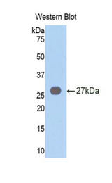 Western blot of recombinant VAV3.