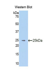 Western blot of recombinant VAV3.