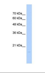 Jurkat cell lysate. Antibody concentration: 1.0 ug/ml. Gel concentration: 12%.