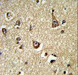 Formalin-fixed and paraffin-embedded human brain tissue reacted with PHGDH Antibody , which was peroxidase-conjugated to the secondary antibody, followed by DAB staining. This data demonstrates the use of this antibody for immunohistochemistry; clinical relevance has not been evaluated.