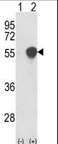 Western blot of PHGDH (arrow) using rabbit polyclonal PHGDH Antibody. 293 cell lysates (2 ug/lane) either nontransfected (Lane 1) or transiently transfected with the PHGDH gene (Lane 2).
