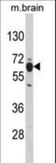 Western blot of PHGDH Antibody in mouse brain tissue lysates (35 ug/lane). PHGDH (arrow) was detected using the purified antibody.