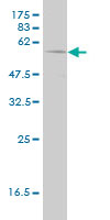 Western blot of PHGDH expression in human liver with PHGDH monoclonal antibody, clone 4A3-1D6.