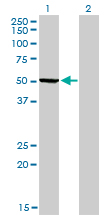 Western blot of PHGDH expression in transfected 293T cell line by PHGDH monoclonal antibody, clone 4A3-1D6.