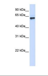 293T cell lysate. Antibody concentration: 1.0 ug/ml. Gel concentration: 12%.
