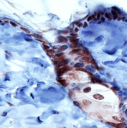 Immunohistochemistry: PIEZO1 Antibody - Analysis of PIEZ01 in mouse epidermis using DAB with hematoxylin counterstain.