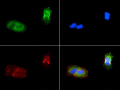Immunocytochemistry/Immunofluorescence: PIEZO1 Antibody - PIEZO1 antibody was tested in A431 cells with FITC (green). Nuclei and alpha-tubulin were counterstained with DAPI (blue) and Dylight 594 (red).