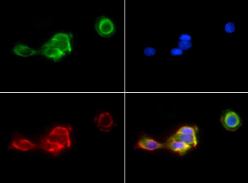 Immunocytochemistry/Immunofluorescence: PIEZO1 Antibody - PIEZO1 antibody was tested in A431 cells with Dylight 488 (green). Nuclei and alpha-tubulin were counterstained with DAPI (blue) and Dylight 594 (red).