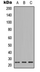 Western blot analysis of PIGF expression in HEK293T (A); Raw264.7 (B); H9C2 (C) whole cell lysates.