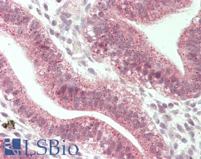 Human Uterus: Formalin-Fixed, Paraffin-Embedded (FFPE)