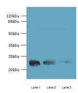 Western blot. All lanes: WDYHV1 antibody at 6 ug/ml. Lane 1: Mouse heart tissue. Lane 2: MCF7 whole cell lysate. Lane 3: U251 whole cell lysate. Secondary antibody: Goat polyclonal to Rabbit IgG at 1:10000 dilution. Predicted band size: 24 kDa. Observed band size: 24 kDa.