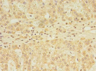 Immunohistochemistry of paraffin-embedded human adrenal gland tissue using antibody at dilution of 1:100.