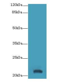 Western blot. All lanes: YKT6 antibody at 12 ug/ml+ A549 whole cell lysate Goat polyclonal to rabbit at 1:10000 dilution. Predicted band size: 22 kDa. Observed band size: 22 kDa.