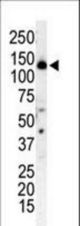 Western blot of anti-PI3KR4 antibody in T-47D cell lysate. PI3KR4 (arrow) was detected using purified antibody. Secondary HRP-anti-rabbit was used for signal visualization with chemiluminescence.