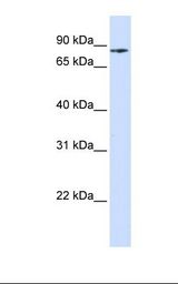 Placenta lysate. Antibody concentration: 1.0 ug/ml. Gel concentration: 12%.